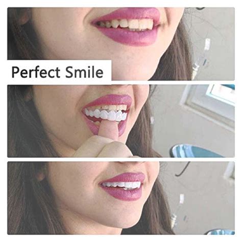 Magic teeth brace instant smile veneers